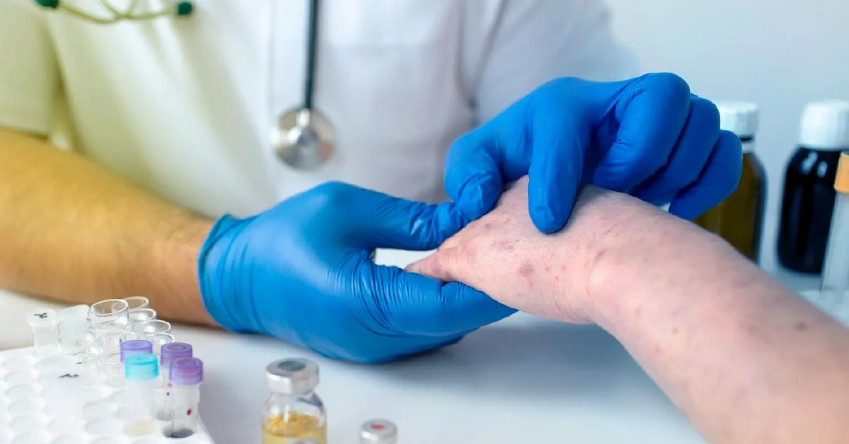 Medical professional assessing skin condition for dermatology clinical trial.